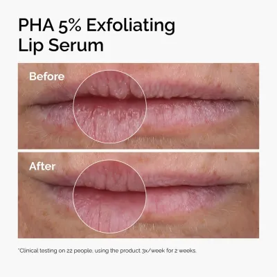 [THE ORDINARY] PHA 5% + Amino Acids Lip Treatment Serum 15ml — view 3