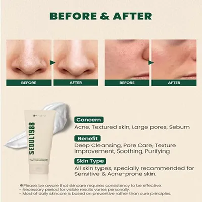 [KSECRET] SEOUL 1988 Cleansing Foam: Pine Cica 1% + Probiotics 150ml