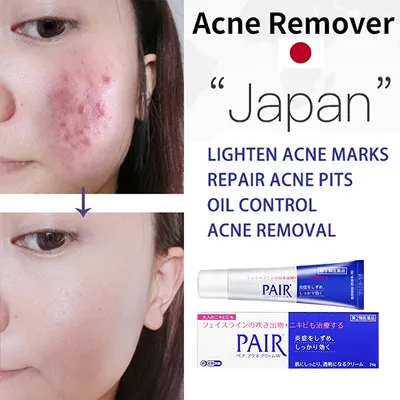 [LION] Pair Acne Cream W – 14g