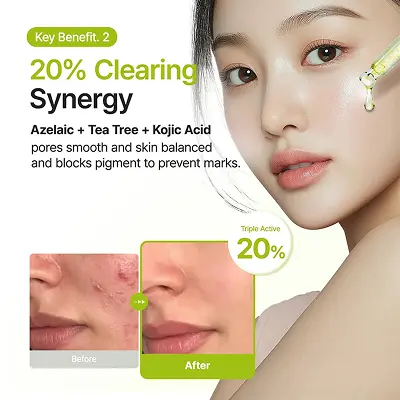 [PURITO SEOUL] Azelaic Acid 10 Kojic Tea Tree Serum 30ml — view 3