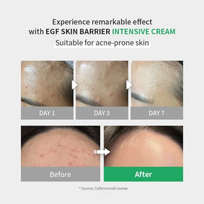 [ZIPIDERM] EGF Skin Barrier Intensive Cream 80ml